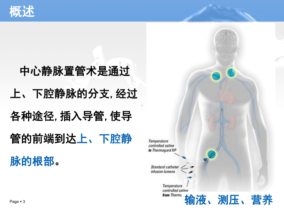 中心静脉置管术的护理课件.ppt_第3页