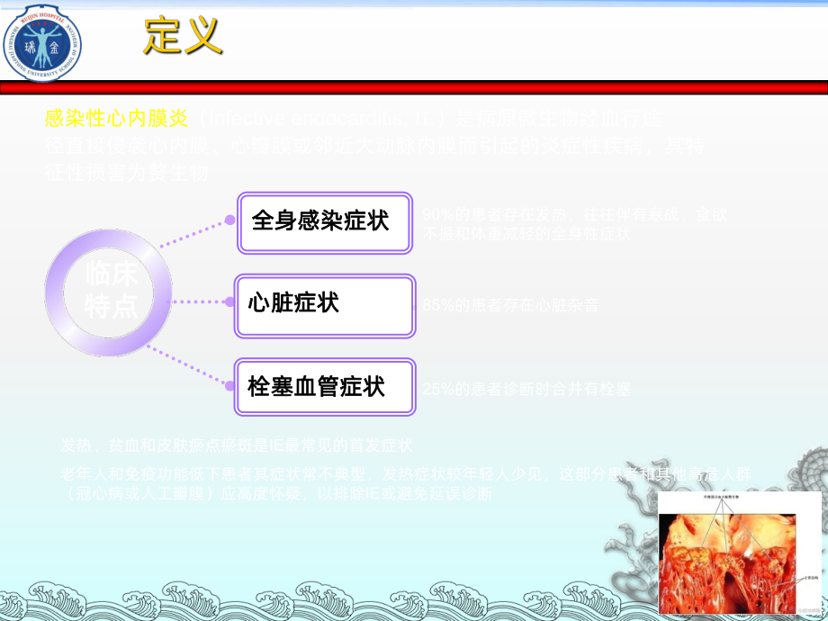 感染性心内膜炎-ppt课件.ppt_第2页