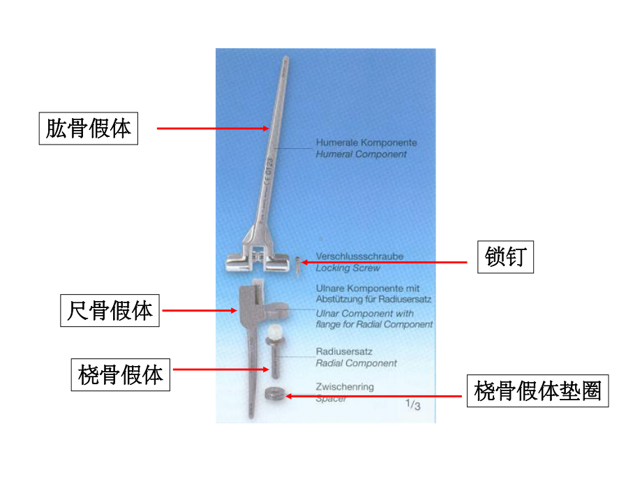 肘关节置换-ppt课件.ppt_第2页