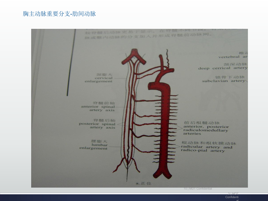 主动脉疾病ppt课件.pptx_第3页