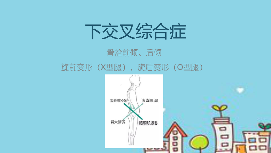 下交叉综合症课件.ppt_第1页