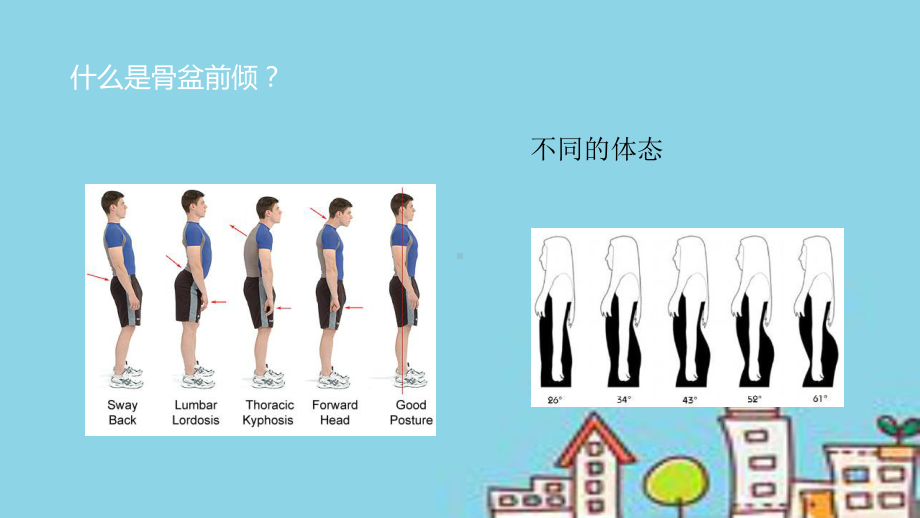 下交叉综合症课件.ppt_第2页