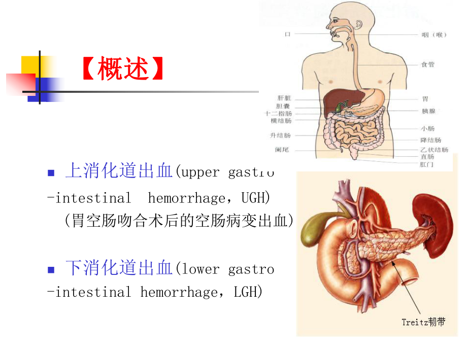 消化道出血个案苏丹课件.ppt_第3页