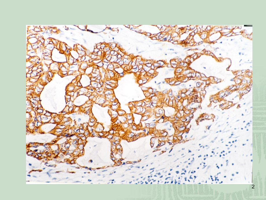 免疫组化结果判断及常见问题的分析PPT课件.ppt_第2页