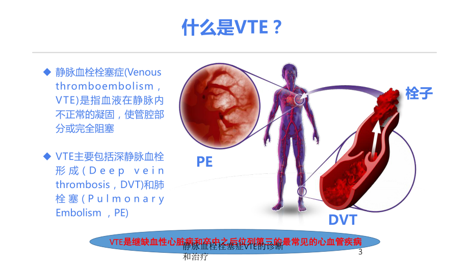 静脉血栓栓塞症VTE的诊断和治疗培训课件.ppt_第3页