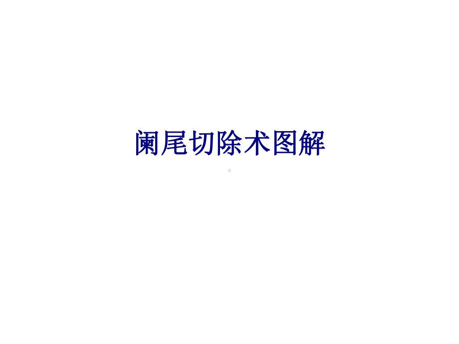 医学阑尾切除术图解专题PPT培训课件.ppt_第1页