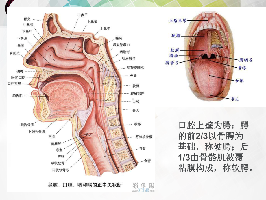 腭部肌上皮瘤的影像学诊断-ppt课件.ppt_第2页