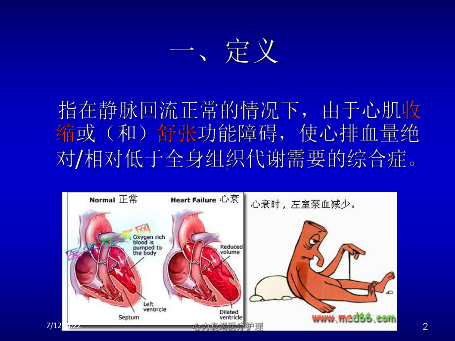 心力衰竭医疗护理课件.ppt_第2页