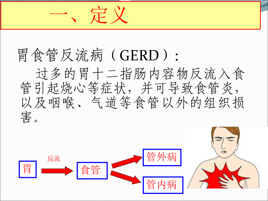 胃食管反流病ppt演示课件.ppt_第2页