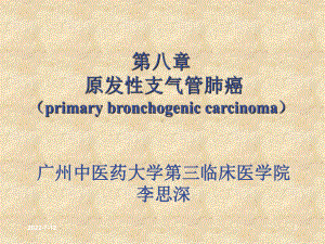 原发支气管肺癌50页PPT课件.ppt