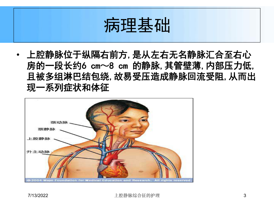 上腔静脉综合征的护理培训课件.ppt_第3页