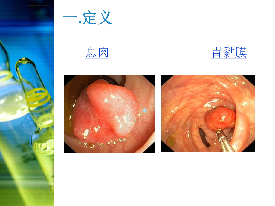 胃息肉内镜手术的护理课件.ppt_第3页