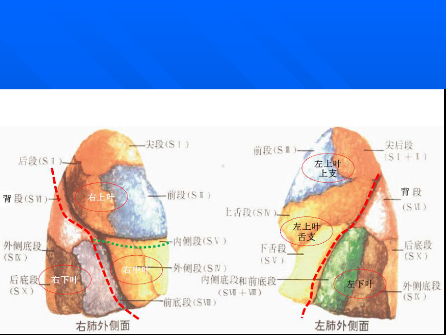 肺部影像学诊断基础-PPT精品课件.pptx_第3页