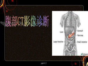 腹部CT影像诊断-ppt课件.ppt