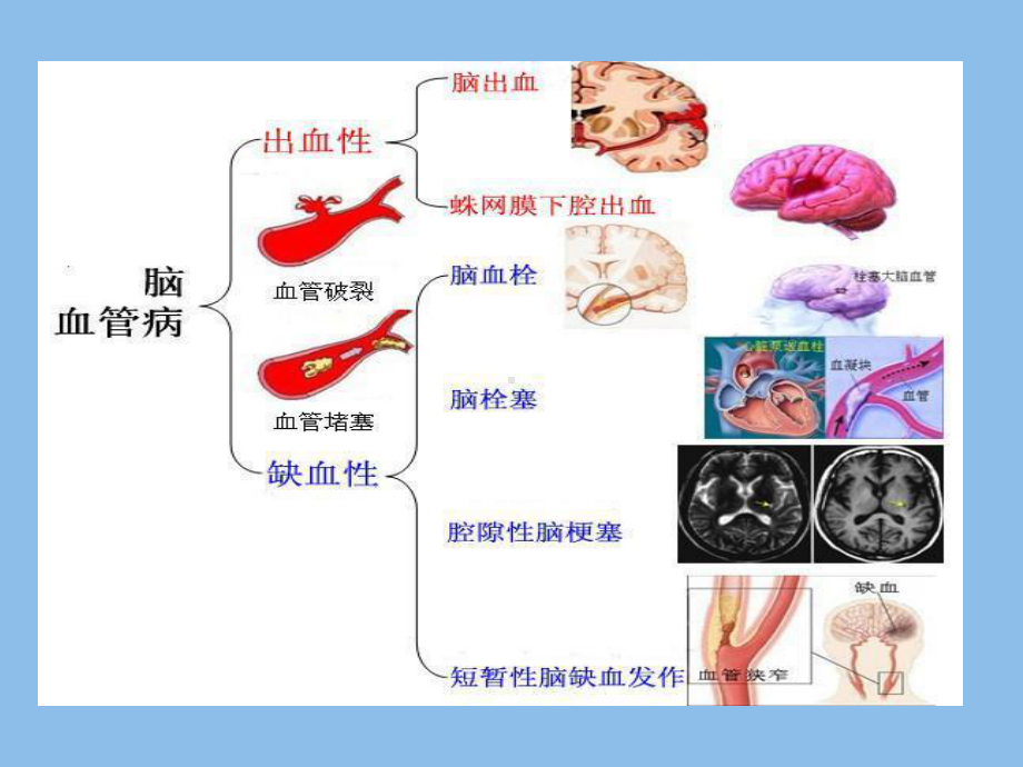 经颅磁治疗仪67页PPT课件.ppt_第3页