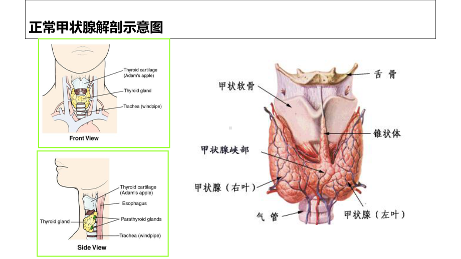 甲状腺毒症-ppt课件.ppt_第3页