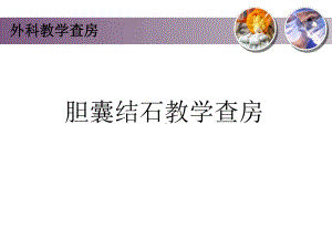 胆囊结石教学查房PPT医学课件.pptx