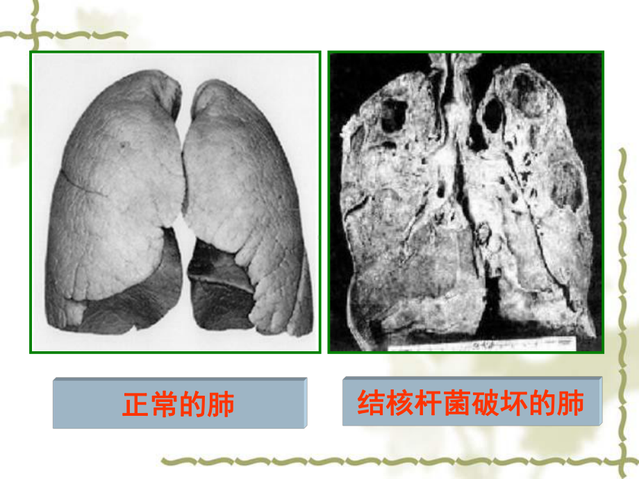 结核病防治知识课件.pptx_第1页