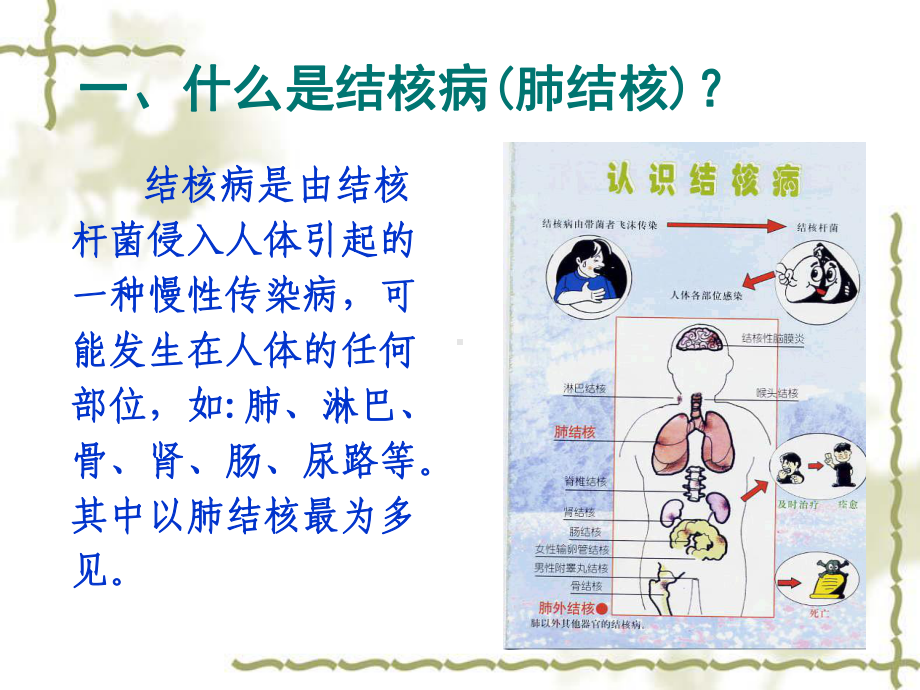 结核病防治知识课件.pptx_第3页