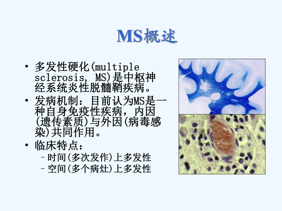 MS及NMO的诊断课件.ppt_第2页