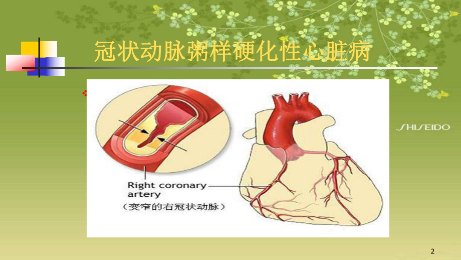 冠心病之心肌梗死PPT课件1.pptx_第2页