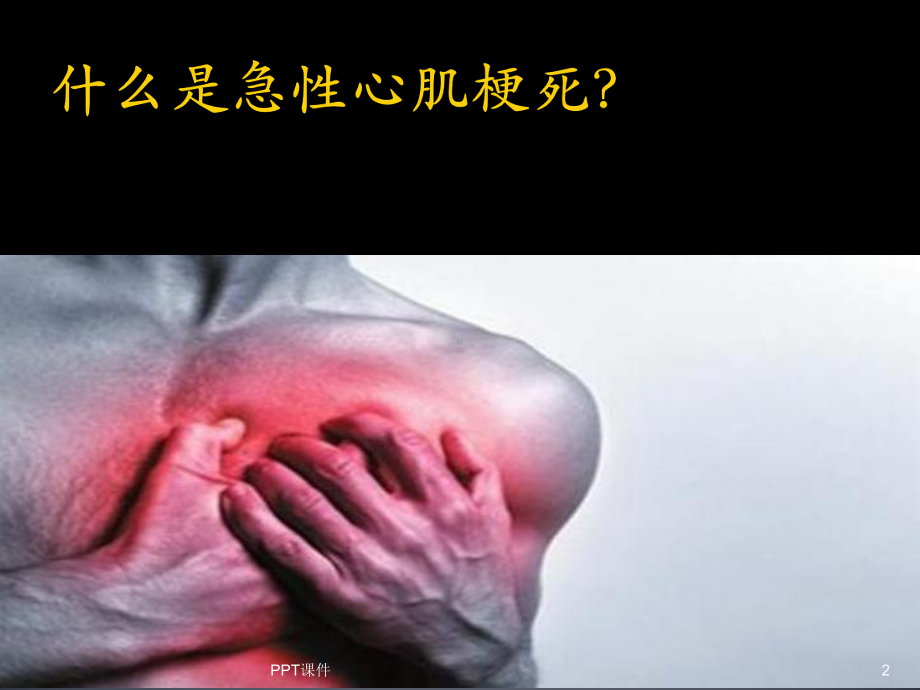 急性心肌梗死的溶栓治疗-ppt课件.ppt_第2页