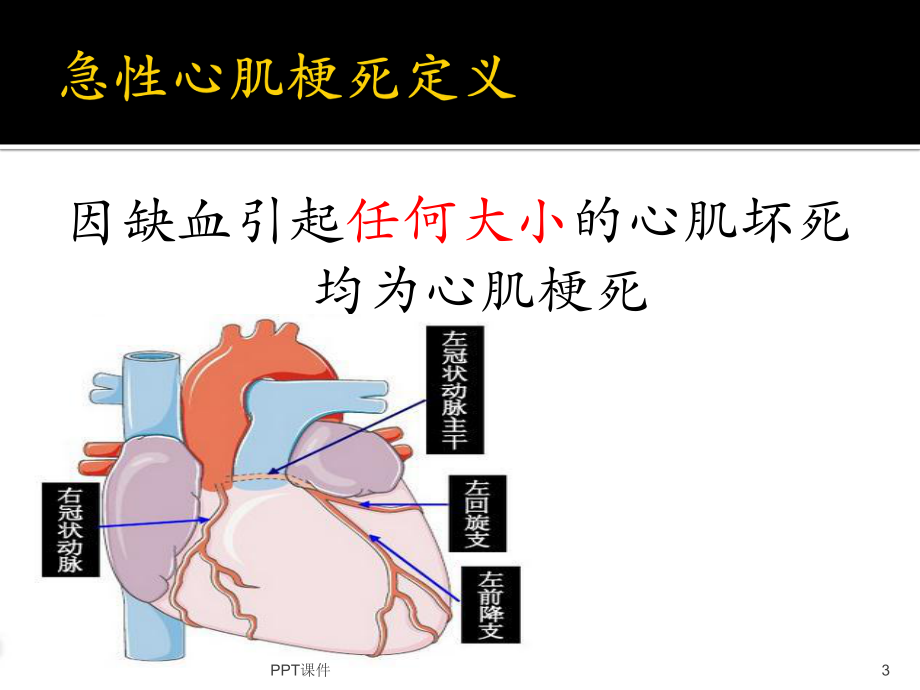 急性心肌梗死的溶栓治疗-ppt课件.ppt_第3页