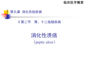 2消化性溃疡-PPT课件.ppt