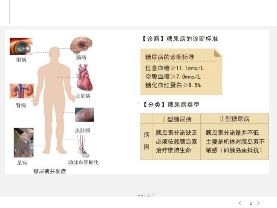 糖尿病足的显微外科治疗（手足外科）-ppt课件.ppt_第2页