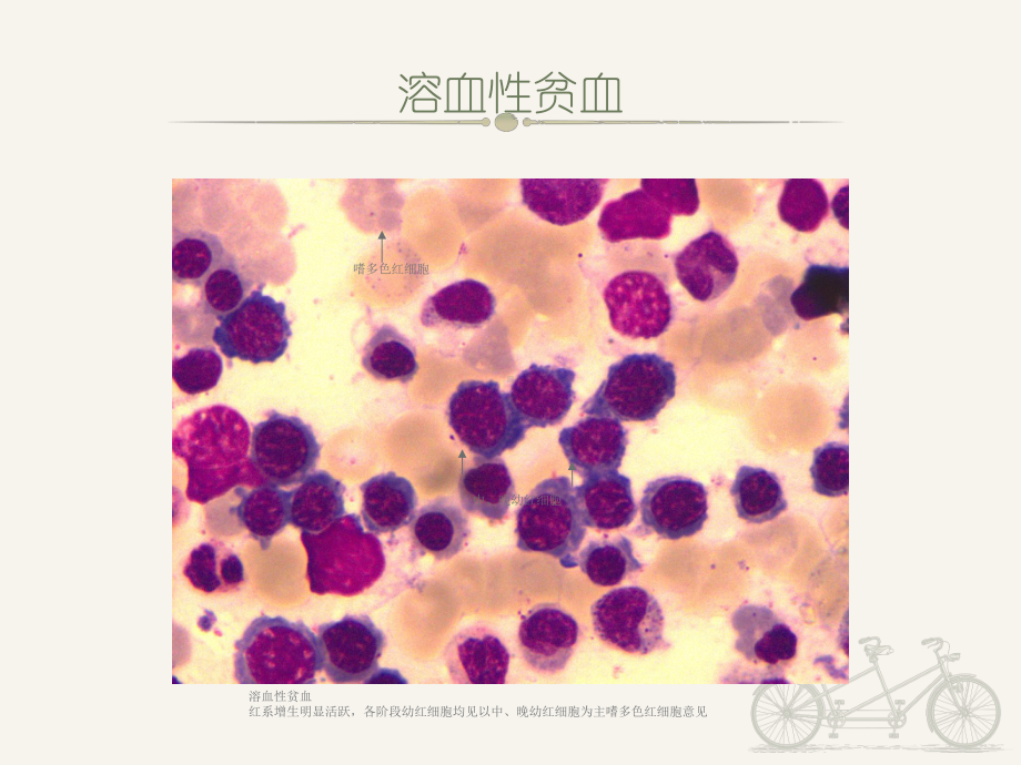 《诊断学》血液学检验图谱-ppt课件.ppt_第3页