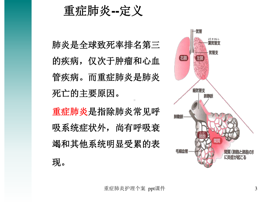 重症肺炎护理个案-ppt课件.ppt_第3页