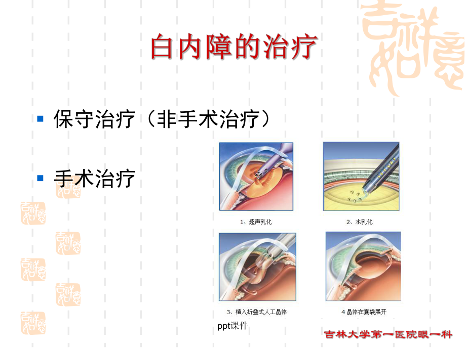 白内障的治疗-ppt课件.ppt_第2页