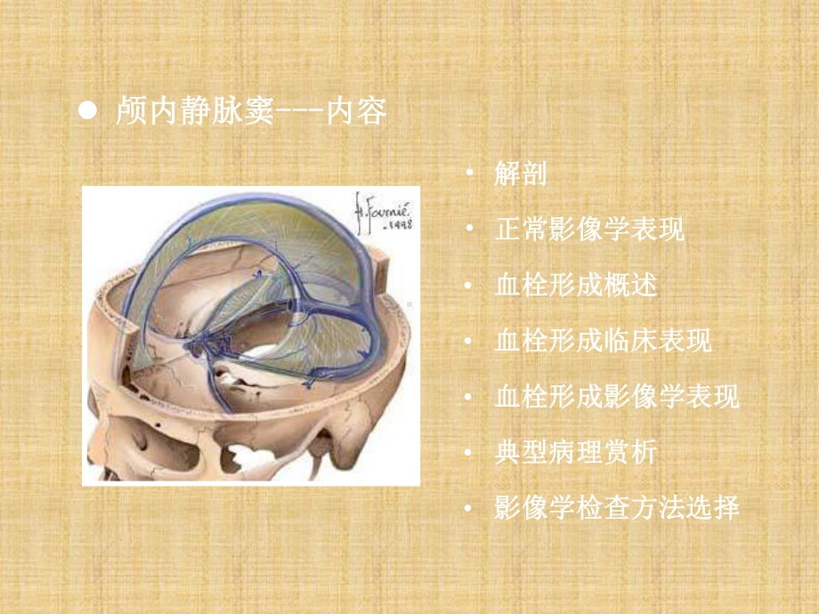 颅内静脉窦血栓形成的特点课件.pptx_第2页