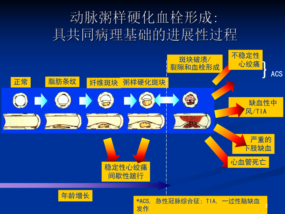 心肌缺血PPT课件.ppt_第2页