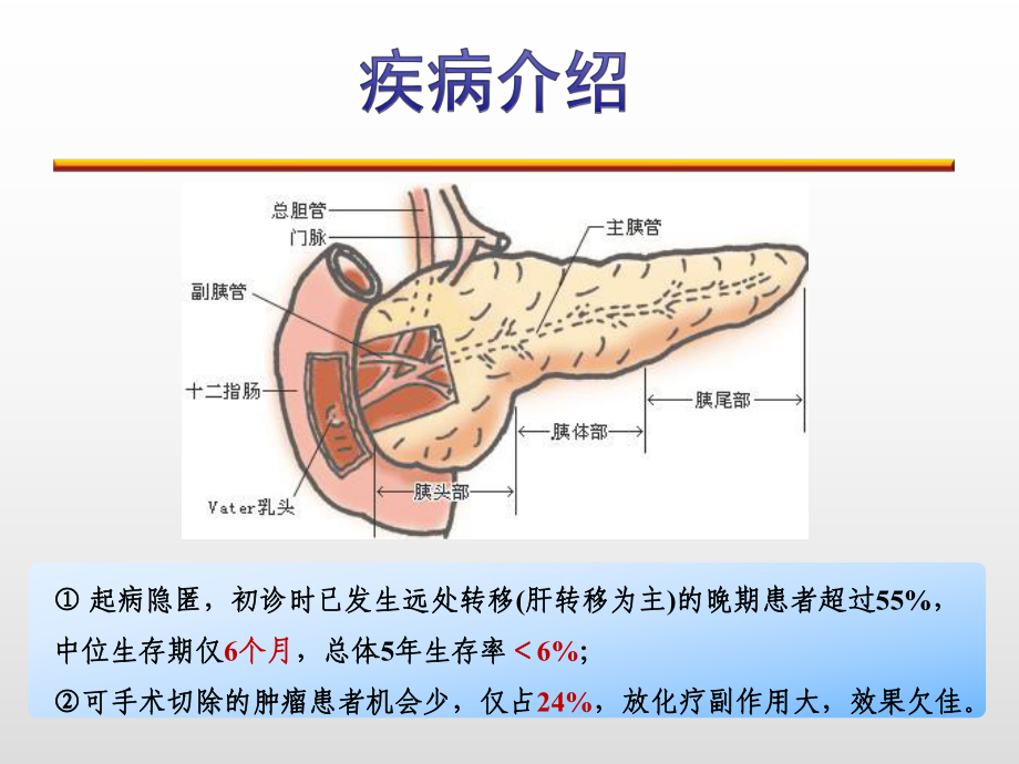 一例晚期胰腺癌病例分析课件.pptx_第2页