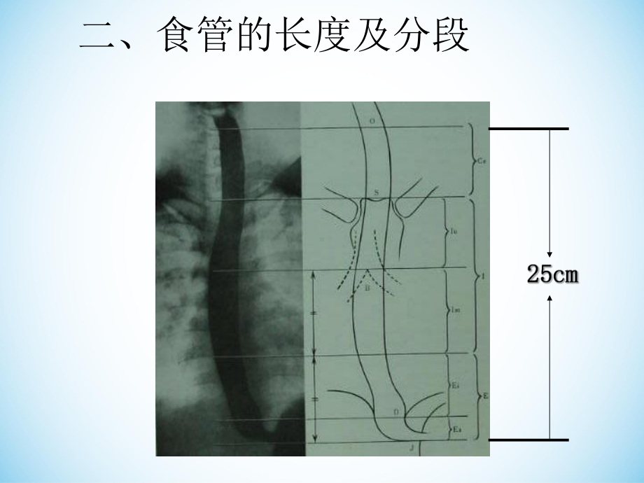 食管的常见疾病及其护理ppt课件.ppt_第3页