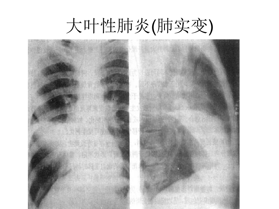 影像诊断图片示例课件.ppt_第2页