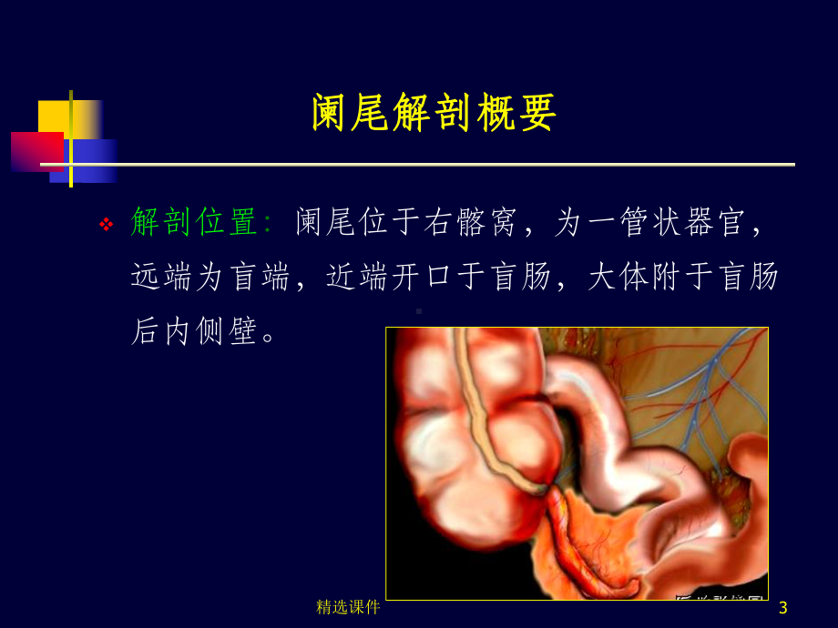 阑尾炎超声诊断73156课件.ppt_第3页