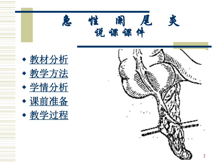 急性阑尾炎说程概论PPT课件.ppt_第2页