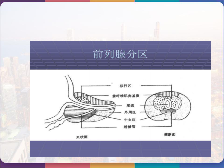 良性前列腺增生病PPT课件.pptx_第3页