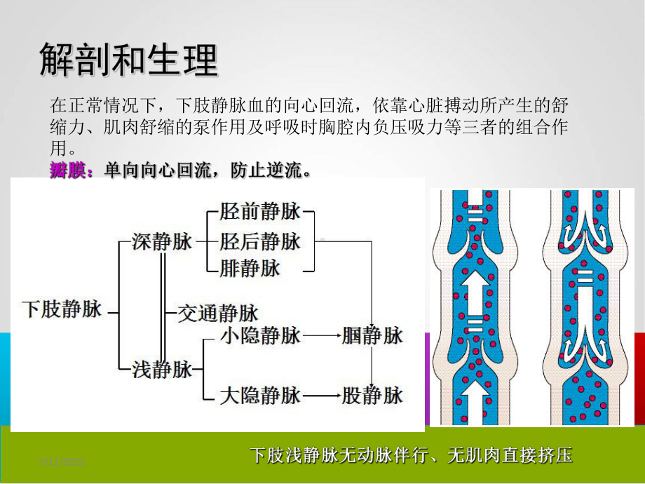 下肢静脉曲张手术方式及并发症的护理PPT培训课件.ppt_第3页