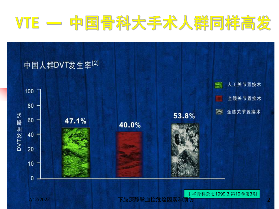 下肢深静脉血栓危险因素和预防课件.ppt_第2页