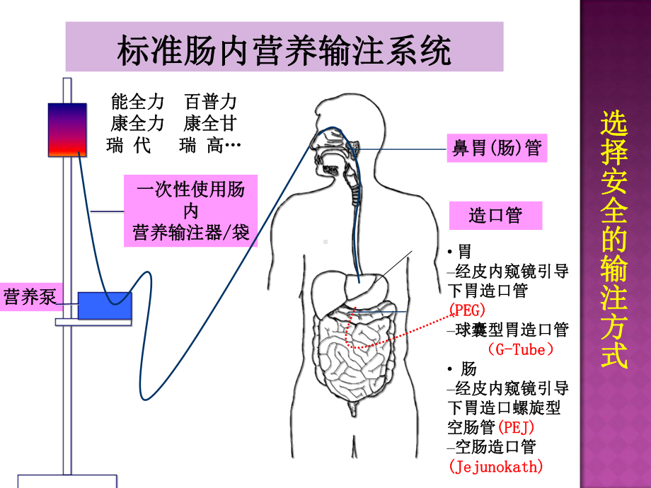 肠内营养并发症的预防及处理课件.ppt_第2页