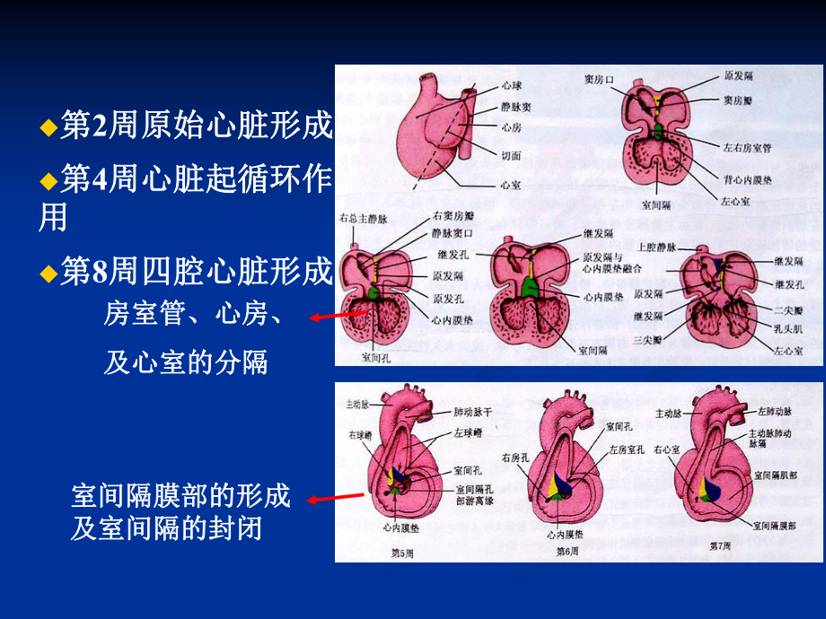 先天性心脏病(2)PPT课件.ppt_第2页