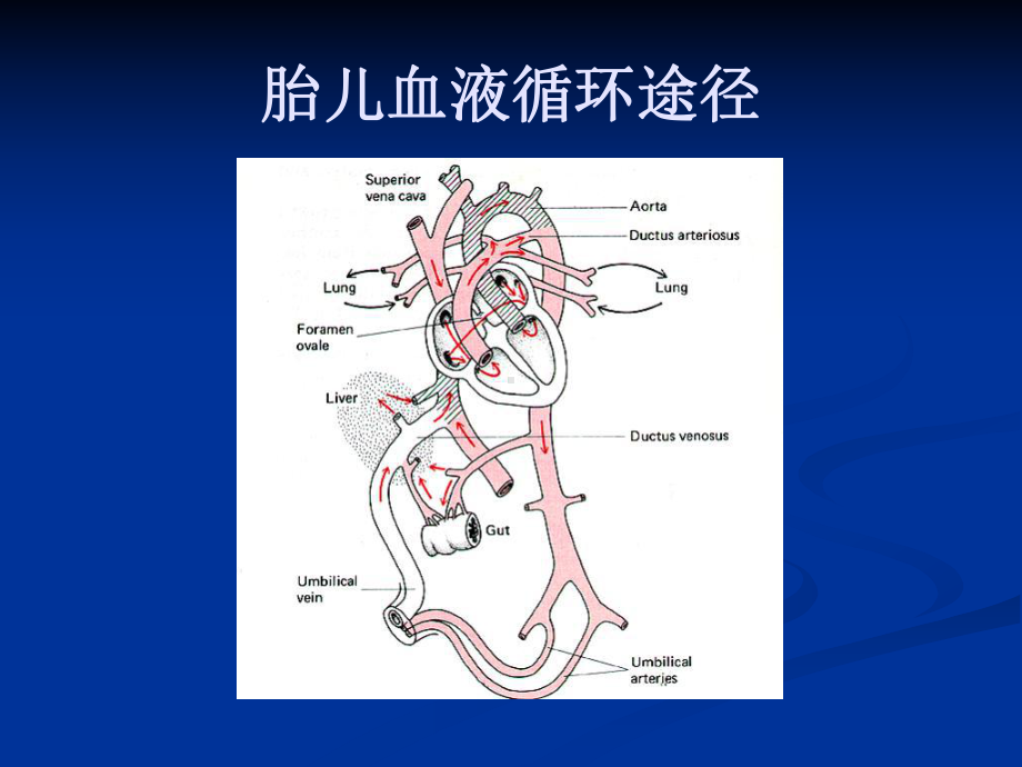 先天性心脏病(2)PPT课件.ppt_第3页