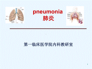 肺炎PPT课件.ppt