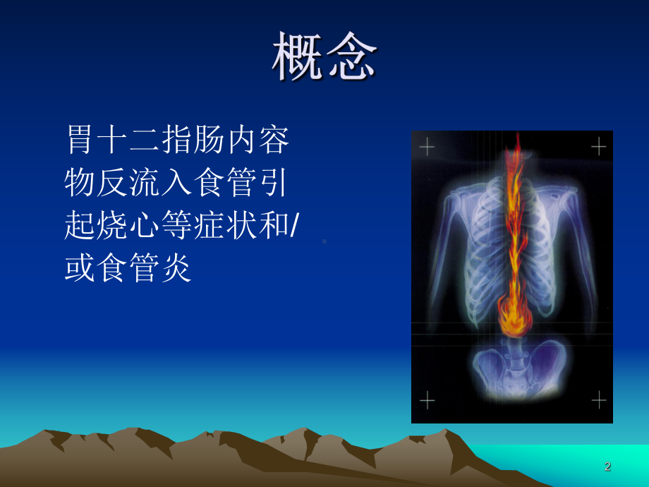 胃食管反流病的诊断与治疗课件.ppt_第2页