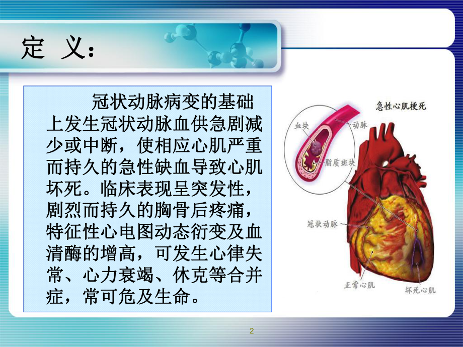 急性心肌梗死的处理与抢救护理PPT课件.ppt_第2页