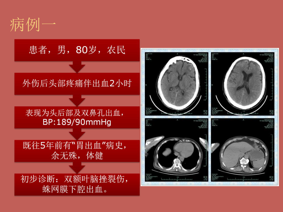 急性胃肠功能损伤PPT课件.pptx_第2页