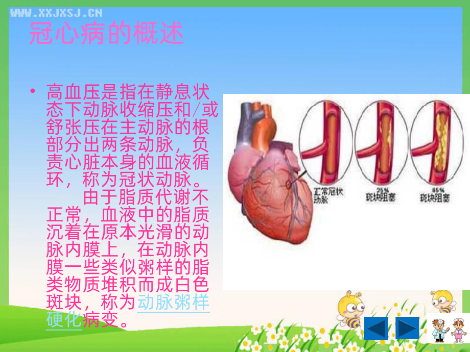 冠心病的护理教学ppt课件.ppt_第3页